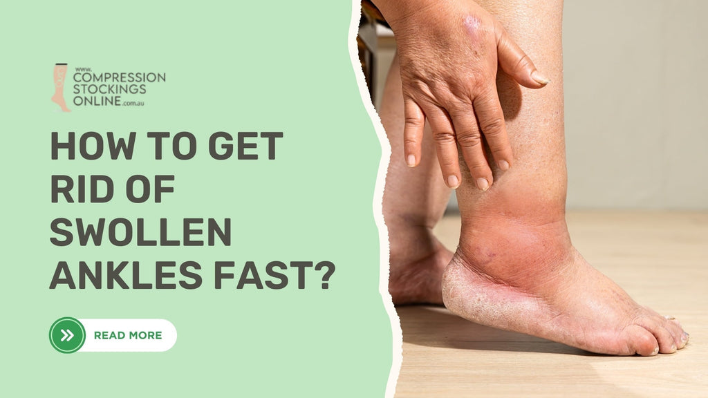 How to Get Rid of Swollen Ankles Fast and Improve Circulation?