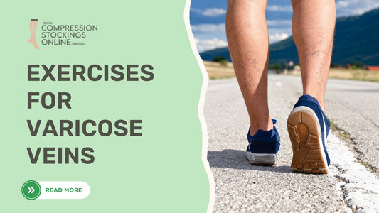 Exercises for varicose veins