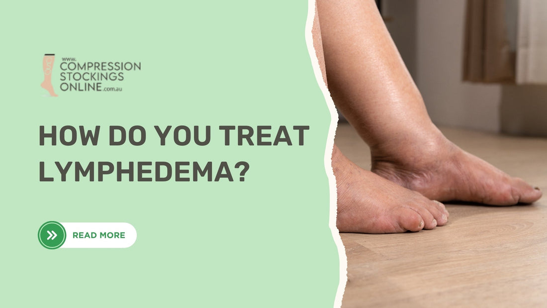 How Do You Treat Lymphedema?