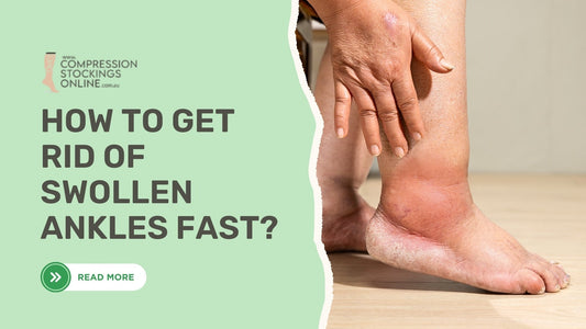 How to Get Rid of Swollen Ankles Fast?