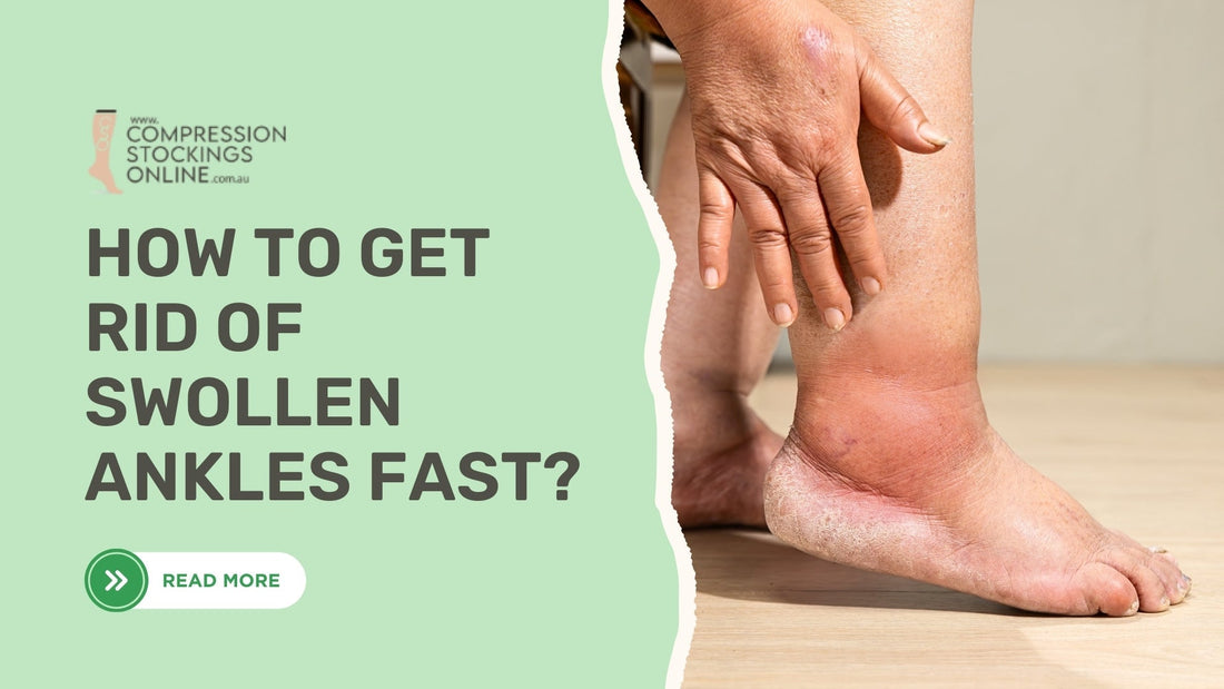 How to Get Rid of Swollen Ankles Fast and Safely