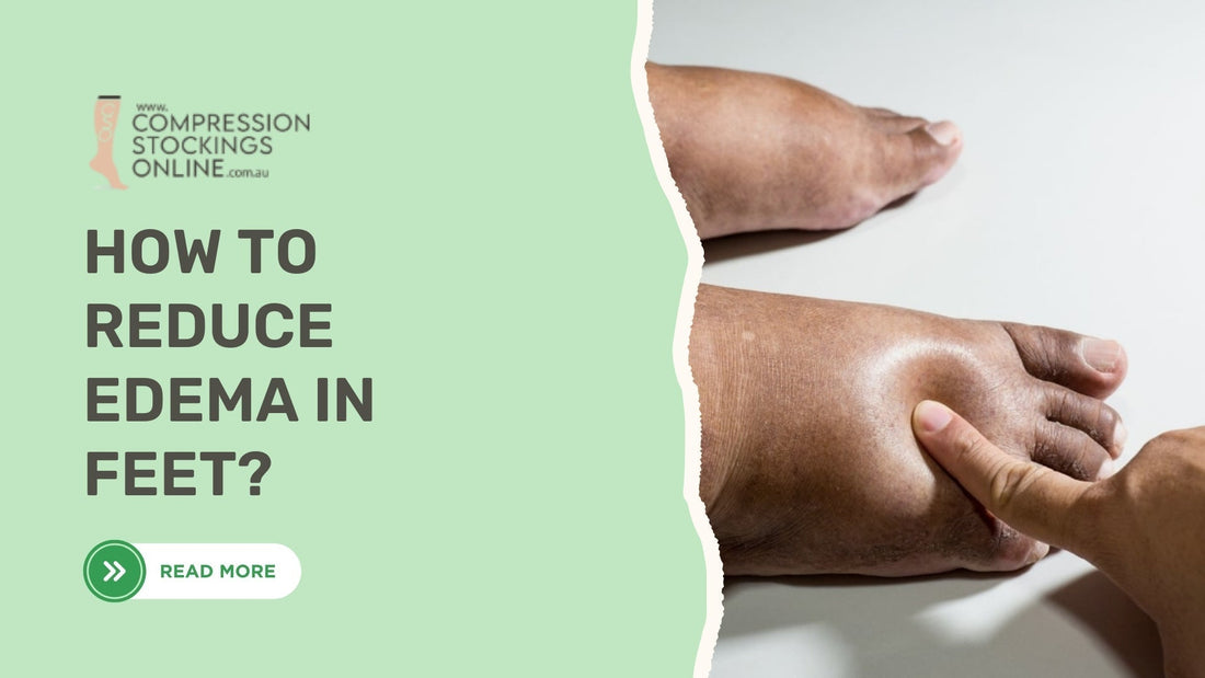 How to Reduce Edema in Feet: Causes & Safe Relief