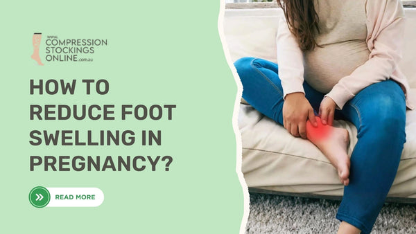 How to Reduce Foot Swelling in Pregnancy?