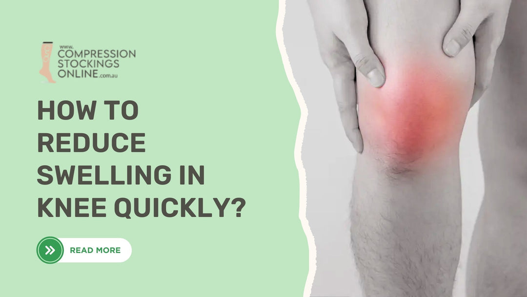 How to Reduce Swelling in Knee Quickly?