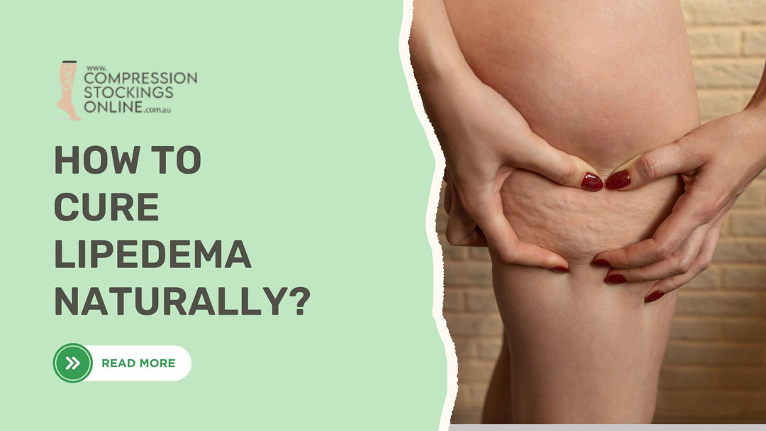 How to Cure Lipedema Naturally? Full Treatment Guide