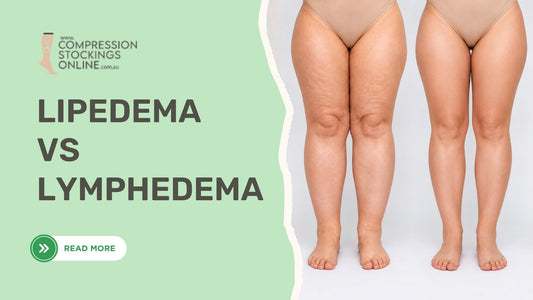 Lipedema vs Lymphedema: Key Differences Explained