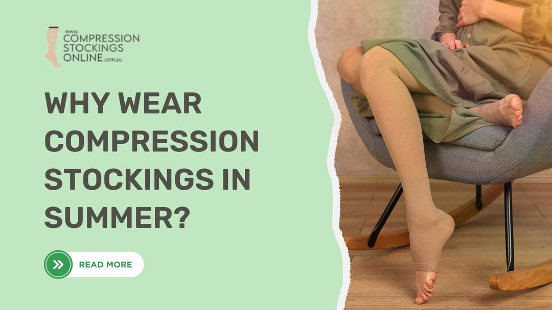 Why Should You Wear Compression Stockings in Summer?