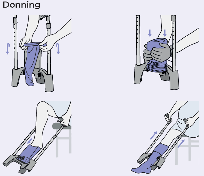 Get SIGVARIS Melany (Butler) Donning & Doffing Device– Compression ...